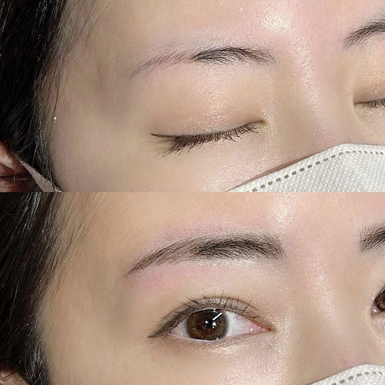 上白石 唯の症例写真