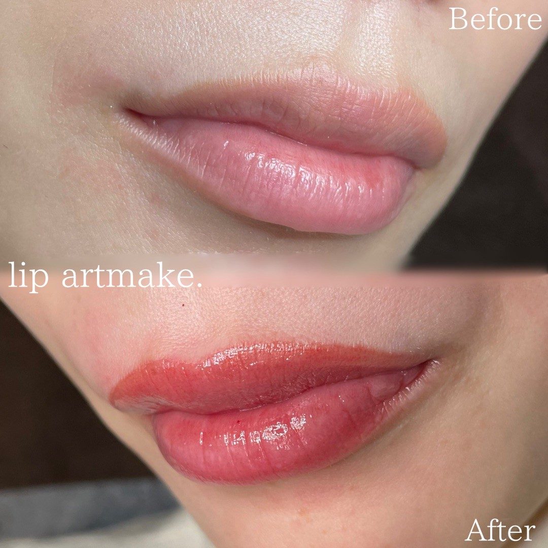 上田 星来の症例写真