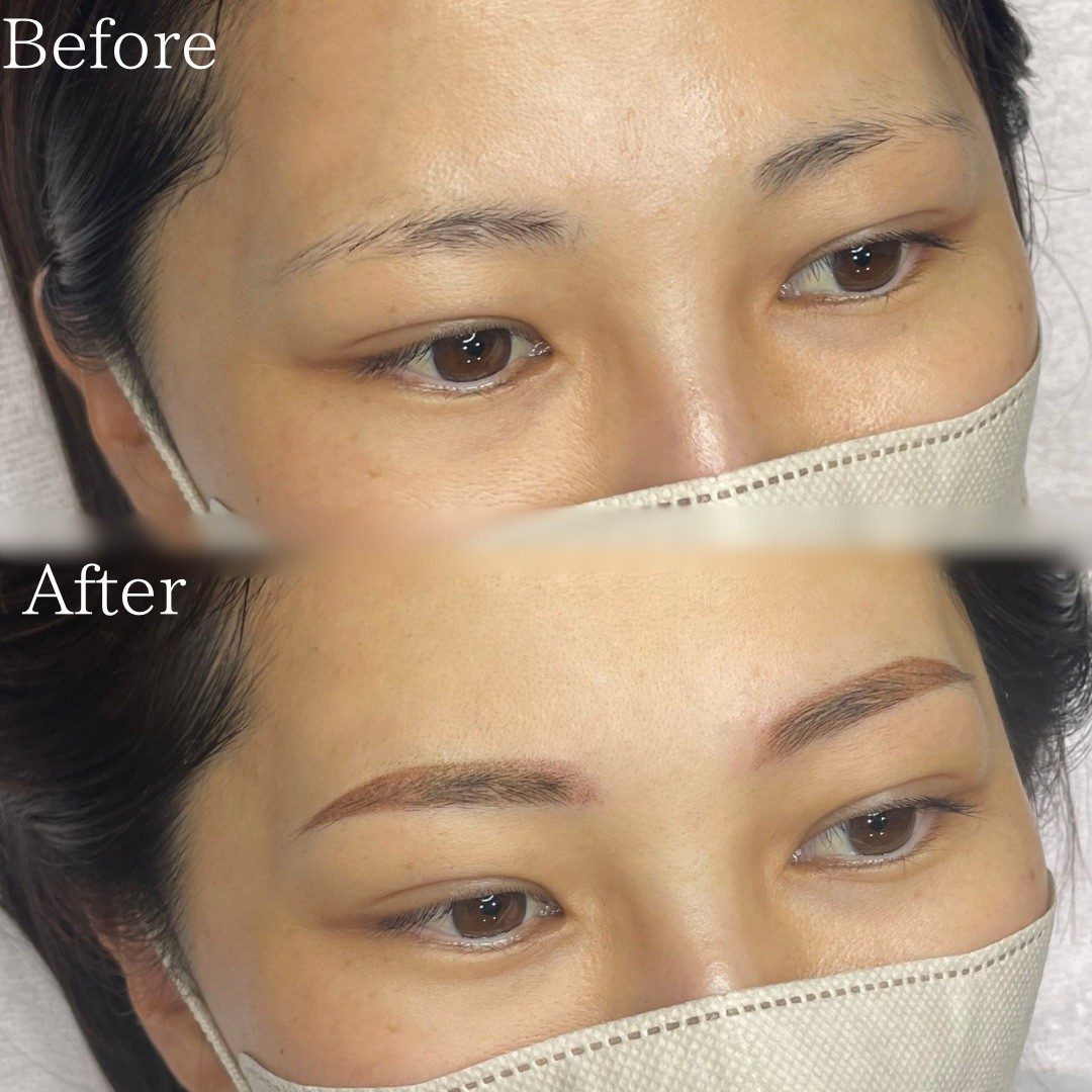 上田 星来の症例写真