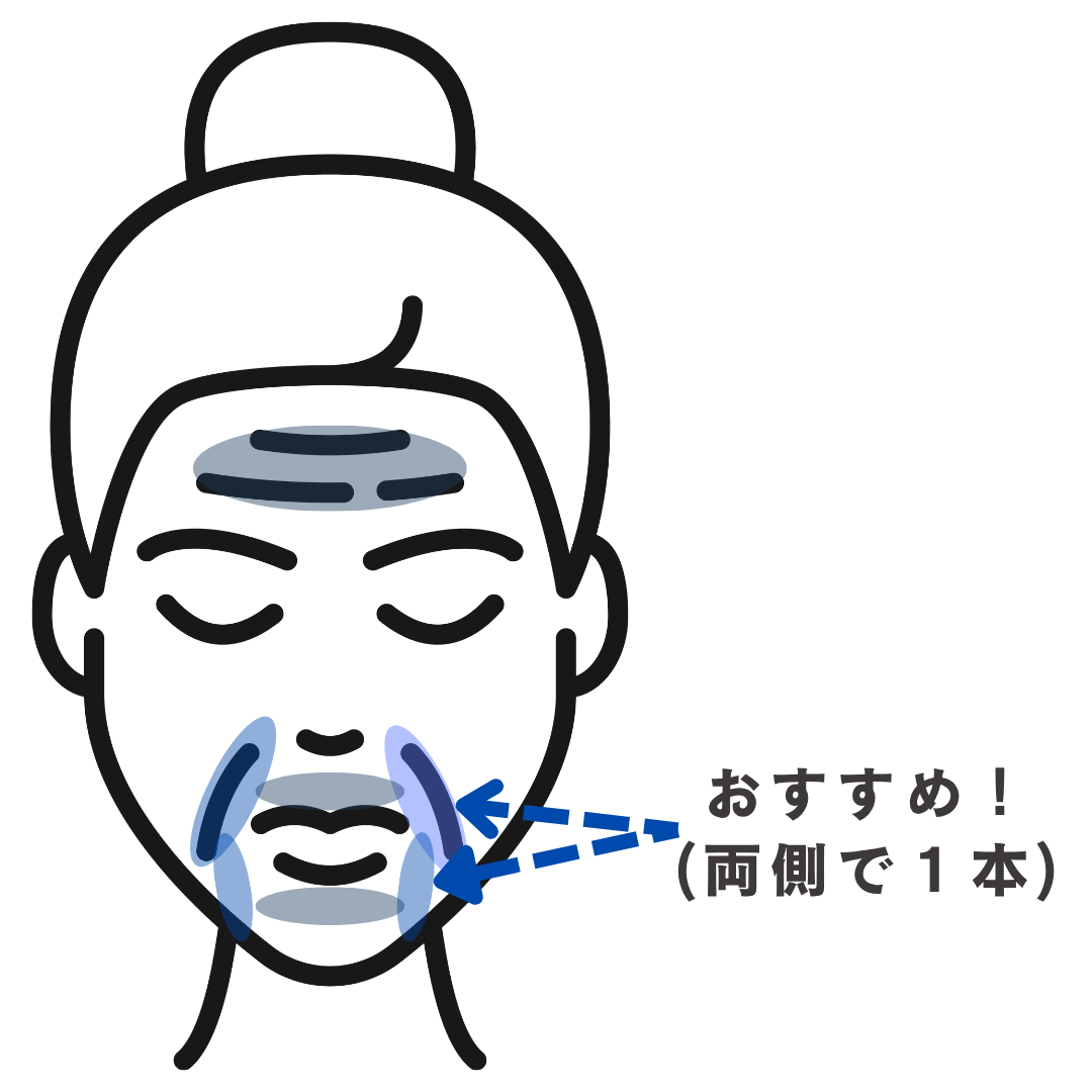 口元のシワに微細注入を行うイラスト