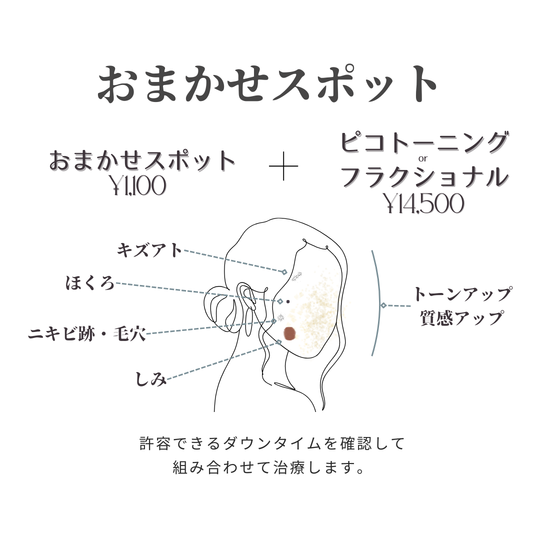 おまかせスポット照射のイメージ