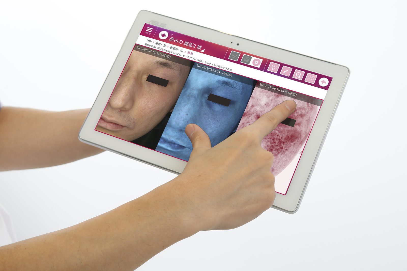 re-Beau2で撮影した結果をタブレットで確認している様子